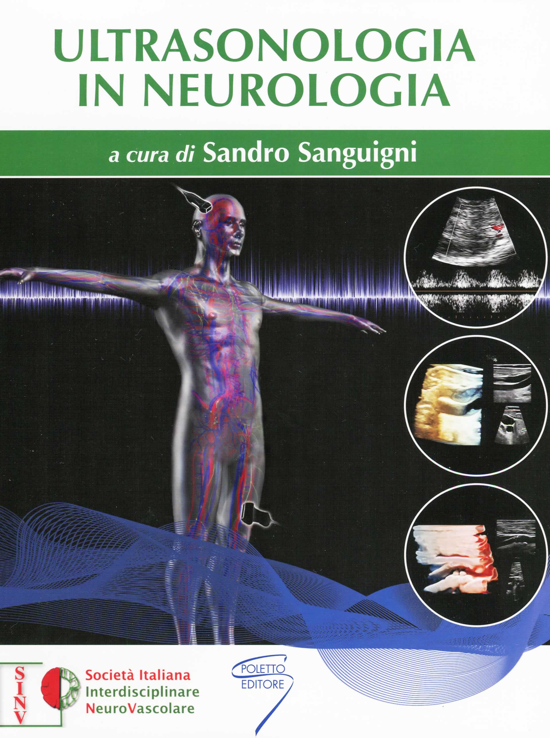 ultrasonologia in neurologia sandro sanguigni